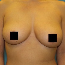 Эстетические характеристики идеальной женской груди