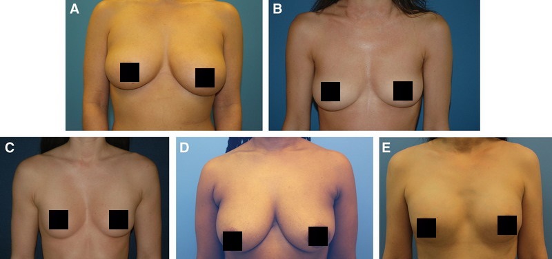 характеристики идеальной женской груди